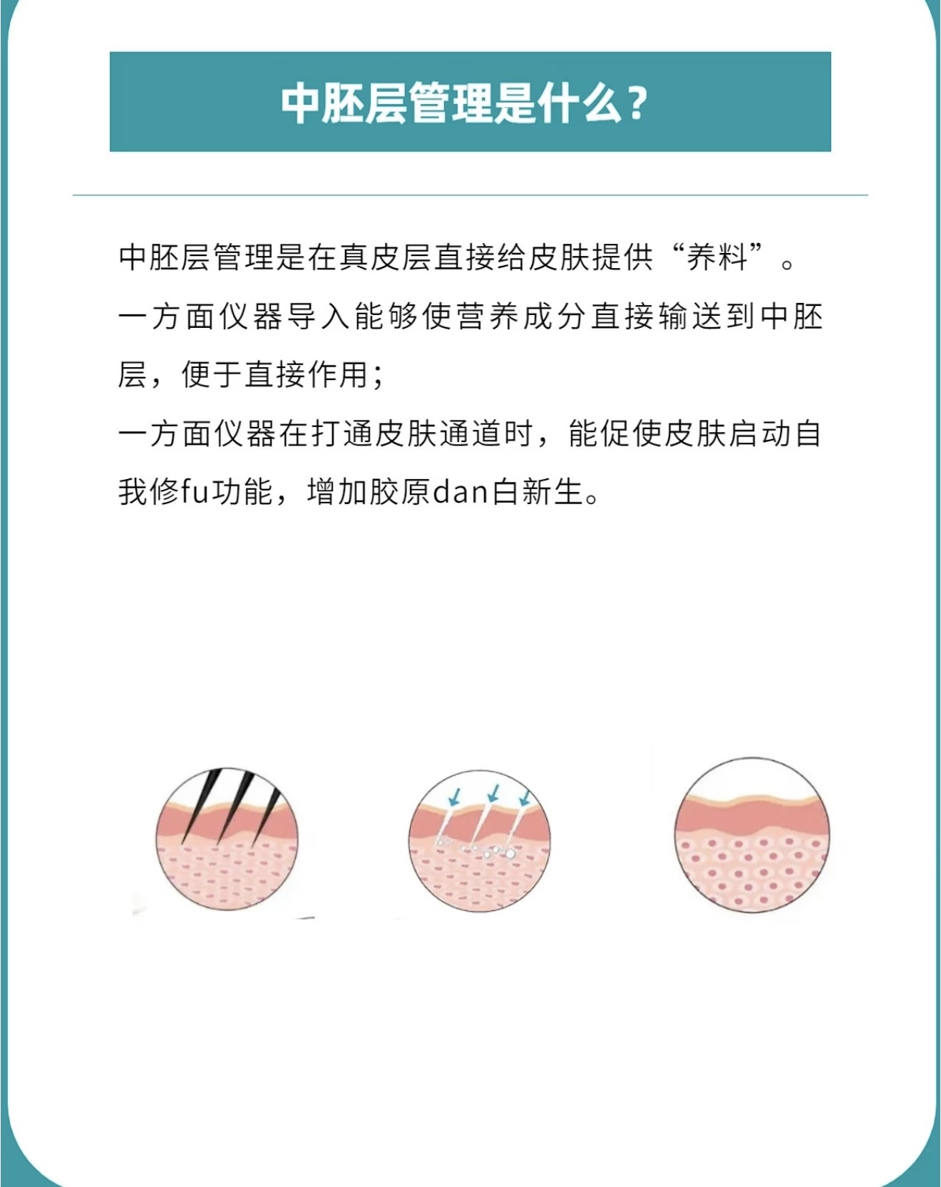什么是中胚层  作用到哪一层-蜜梓嫣皮肤管理